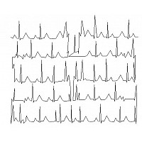 ekg pano 001